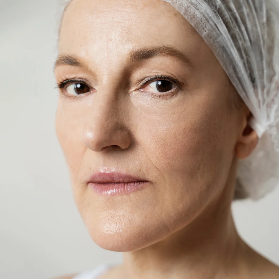 Depois harmonização facial