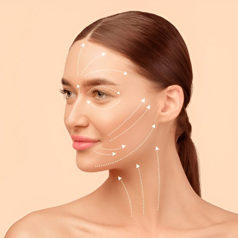 Bioestimulador de colagenio com harmonização orofacial